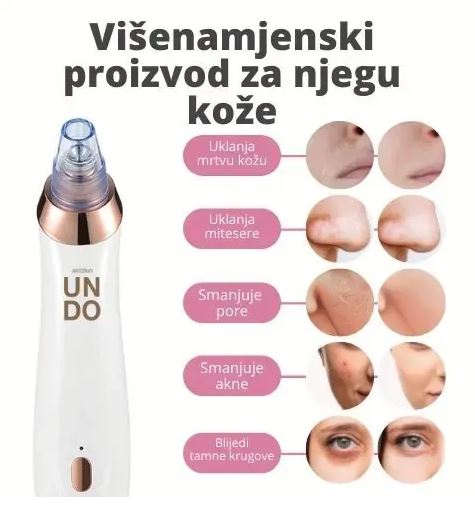 APARAT ZA ČIĆENJE LICA + GRATIS KREMA OD PUŽEVE SLUZI